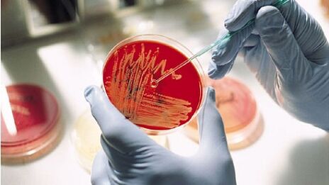 culture bactérienne pour la prostatite pour prescrire des antibiotiques